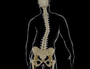 Adolescent Idiopathic Scoliosis: Understanding the Condition and Its Treatment