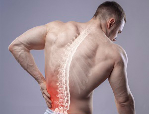 Common Causes of Lower Back Pain