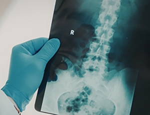 What Are the Risks of Spine Surgery? Complications Explained