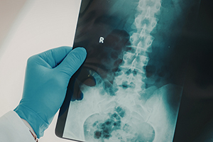 What Are the Risks of Spine Surgery? Complications Explained